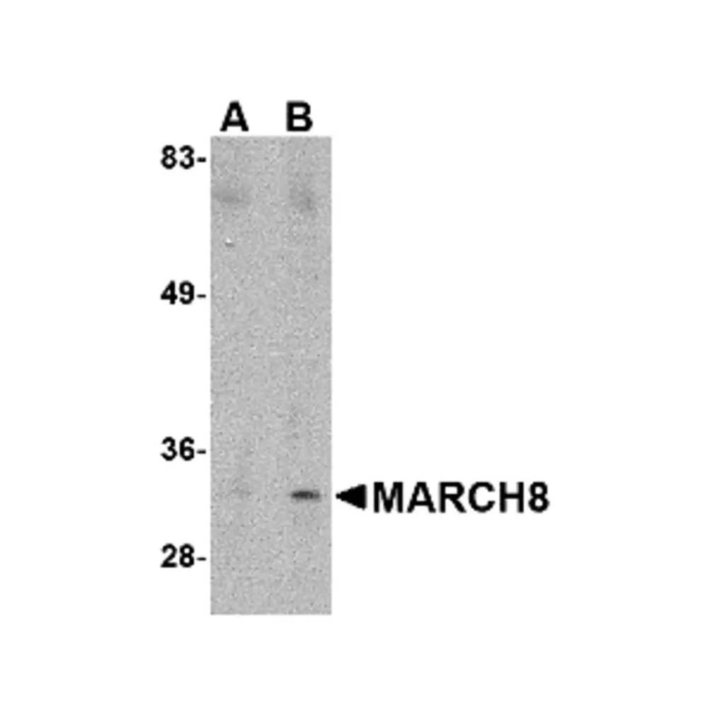ProSci 4885 MARCH8 Antibody, ProSci, 0.1 mg/Unit Primary Image