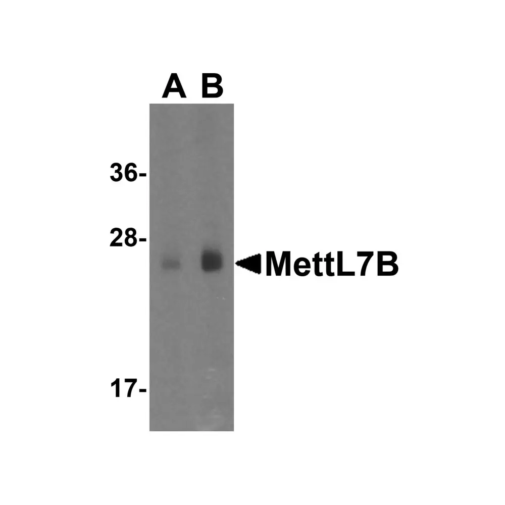 ProSci 4891 MettL7B Antibody, ProSci, 0.1 mg/Unit Primary Image