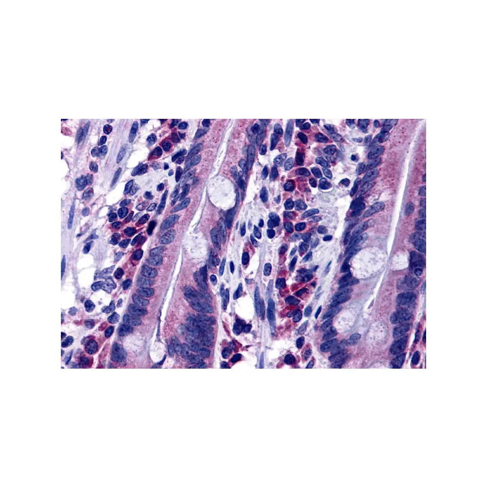 ProSci 4893 DISP2 Antibody, ProSci, 0.1 mg/Unit Primary Image