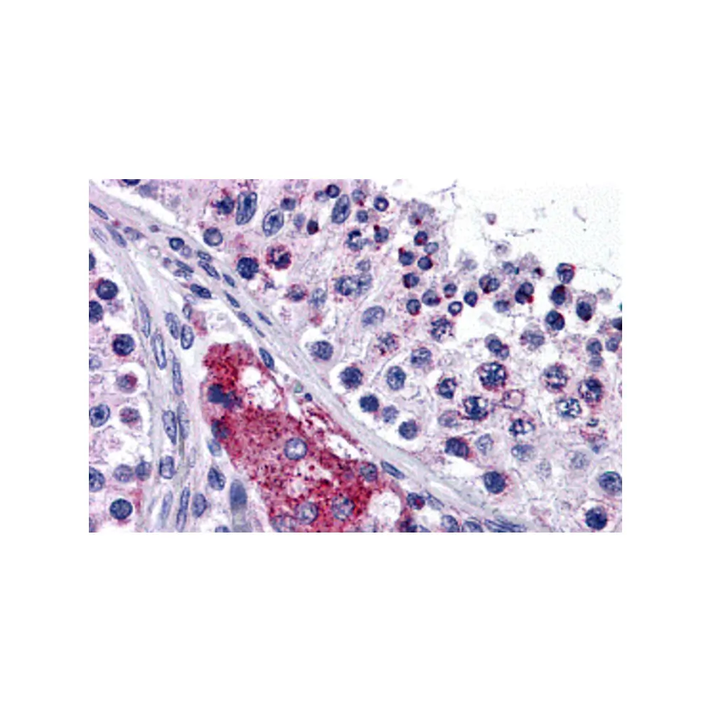 ProSci 4915 PTCHD2 Antibody, ProSci, 0.1 mg/Unit Primary Image