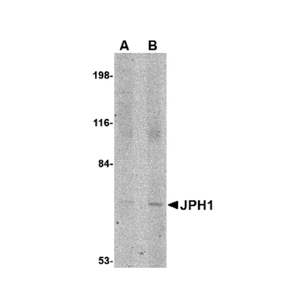 ProSci 4917_S JPH1 Antibody, ProSci, 0.02 mg/Unit Primary Image