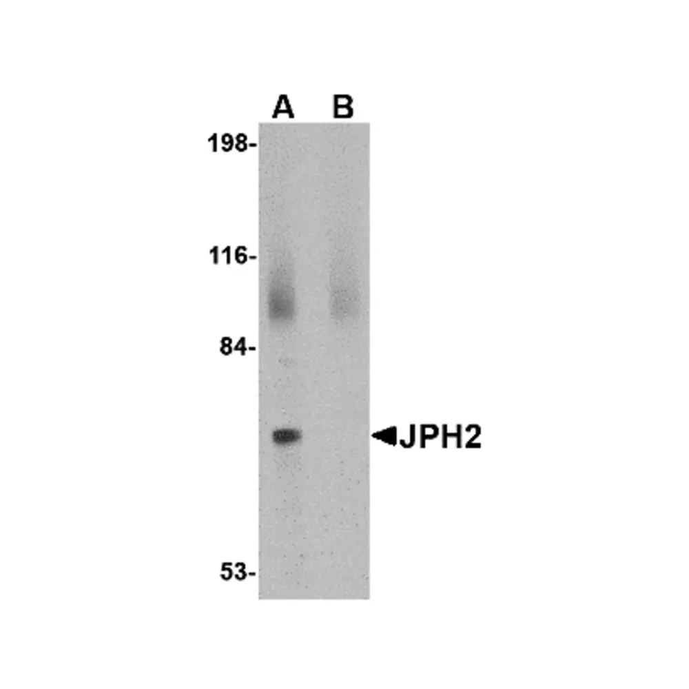 ProSci 4919 JPH2 Antibody, ProSci, 0.1 mg/Unit Primary Image