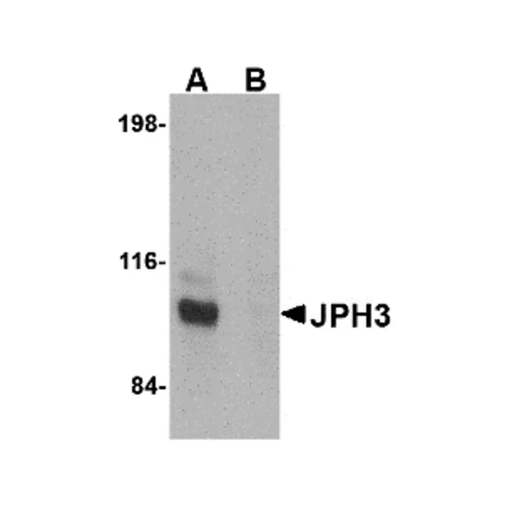 ProSci 4921 JPH3 Antibody, ProSci, 0.1 mg/Unit Primary Image