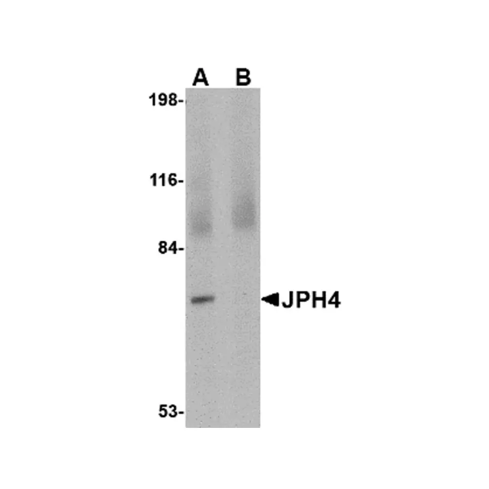 ProSci 4923_S JPH4 Antibody, ProSci, 0.02 mg/Unit Primary Image