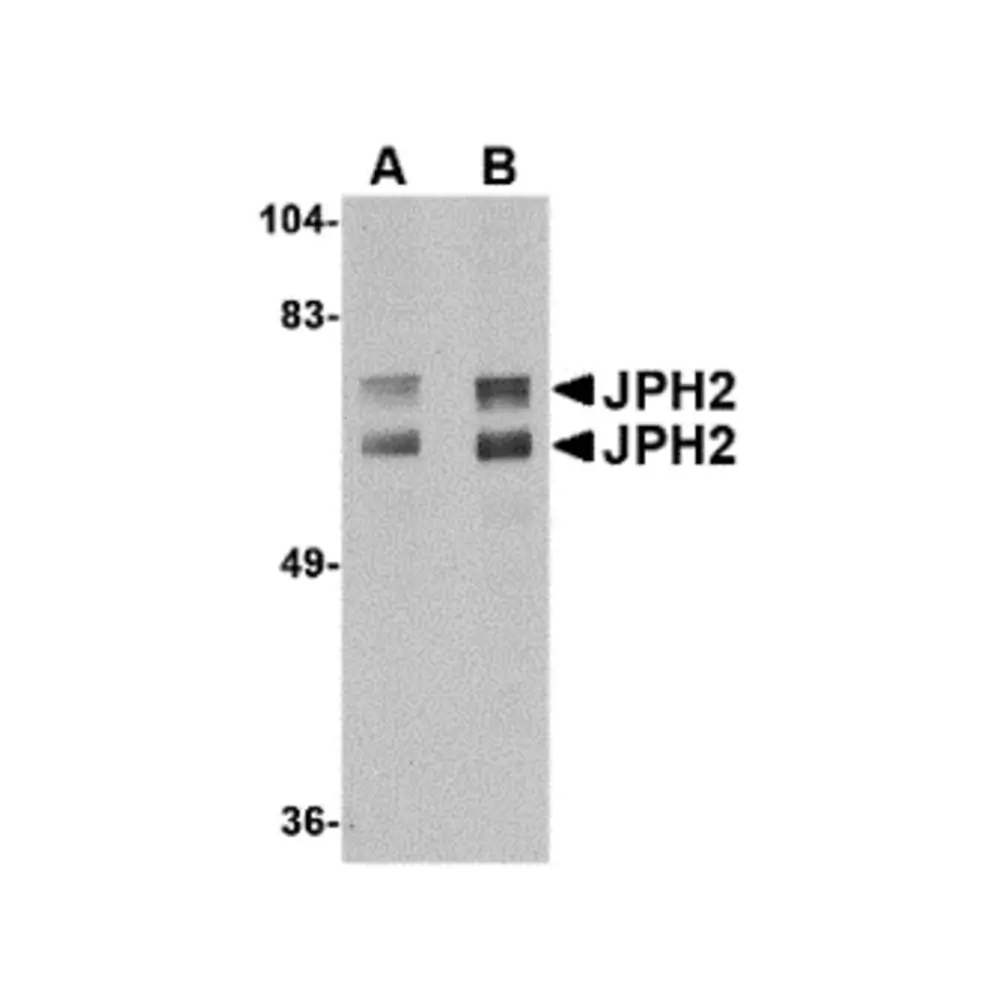 ProSci 4929_S JPH2 Antibody, ProSci, 0.02 mg/Unit Primary Image