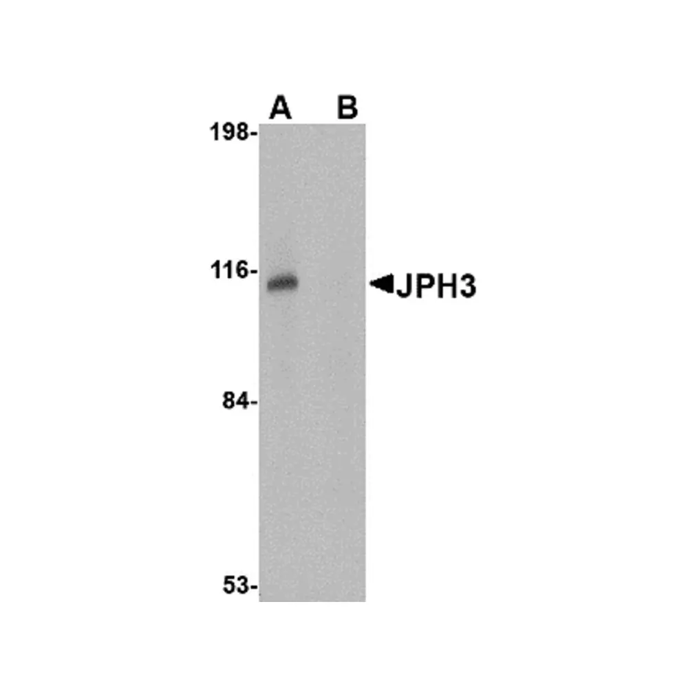 ProSci 4931 JPH3 Antibody, ProSci, 0.1 mg/Unit Primary Image