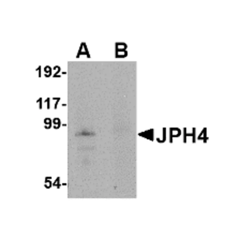 ProSci 4933 JPH4 Antibody, ProSci, 0.1 mg/Unit Primary Image