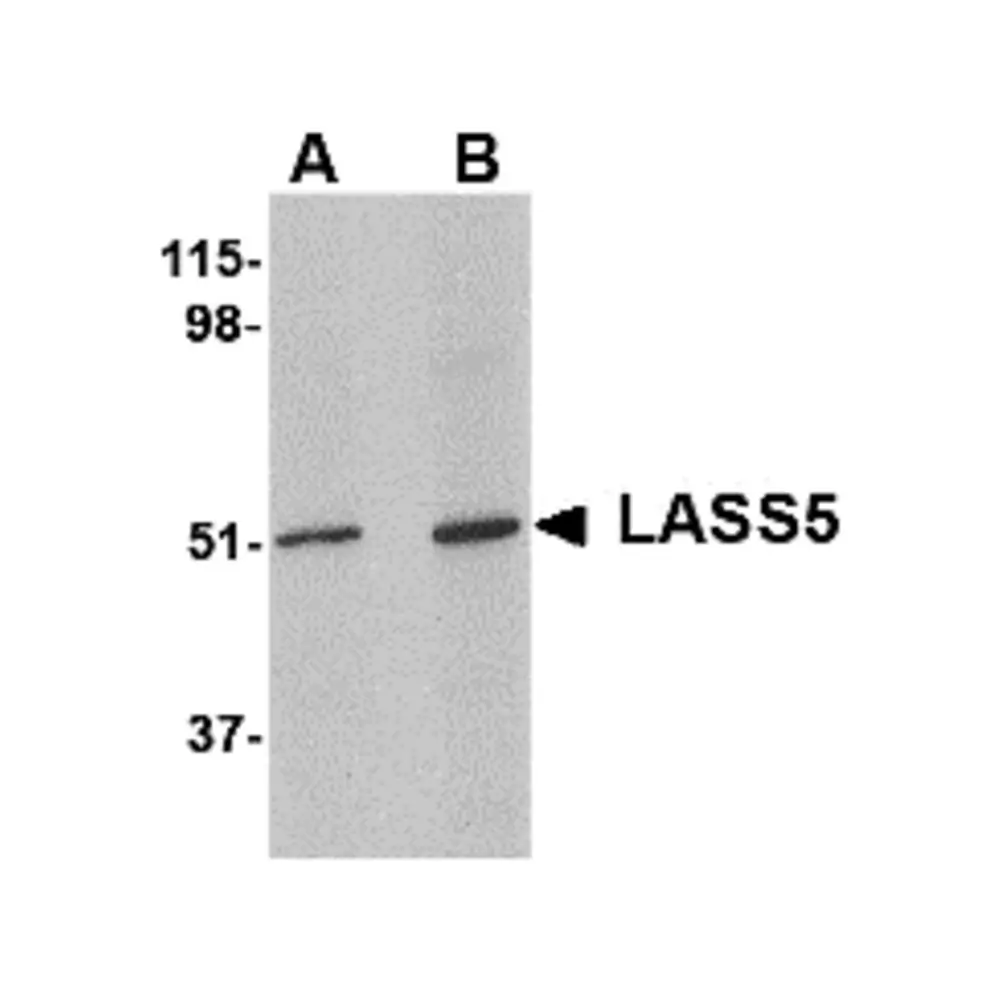 ProSci 4939_S LASS5 Antibody, ProSci, 0.02 mg/Unit Primary Image