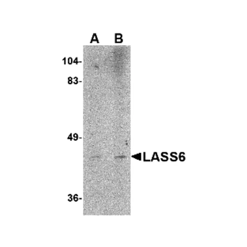 ProSci 4941_S LASS6 Antibody, ProSci, 0.02 mg/Unit Primary Image