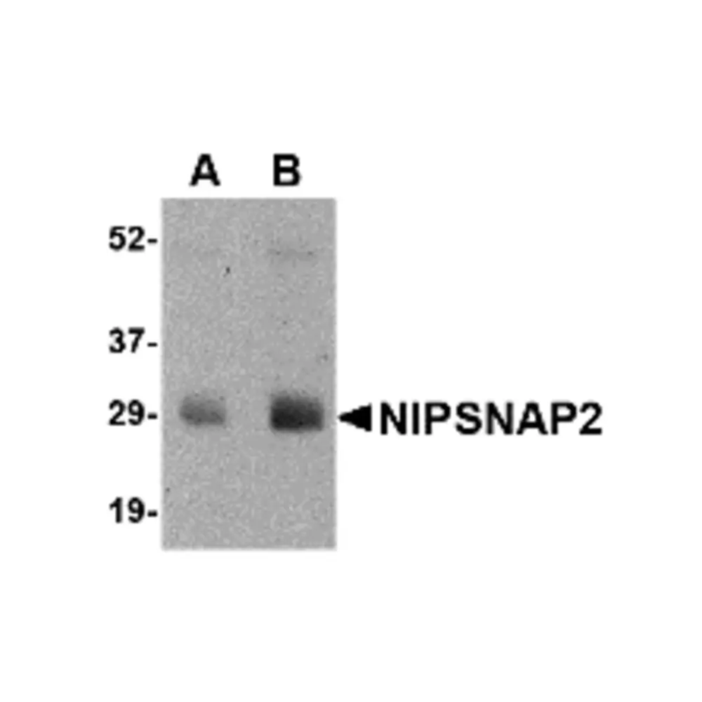 ProSci 4943_S NIPSNAP2 Antibody, ProSci, 0.02 mg/Unit Primary Image