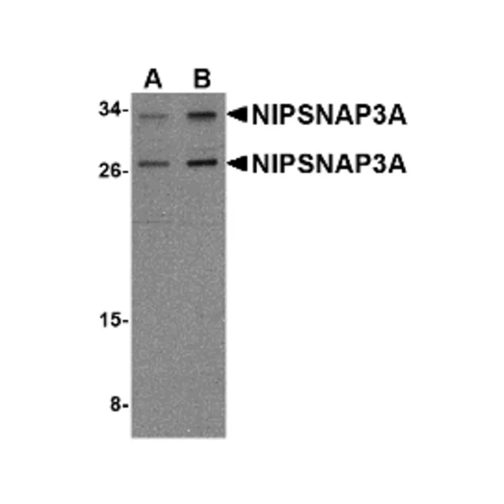 ProSci 4947_S NIPSNAP3A Antibody, ProSci, 0.02 mg/Unit Primary Image