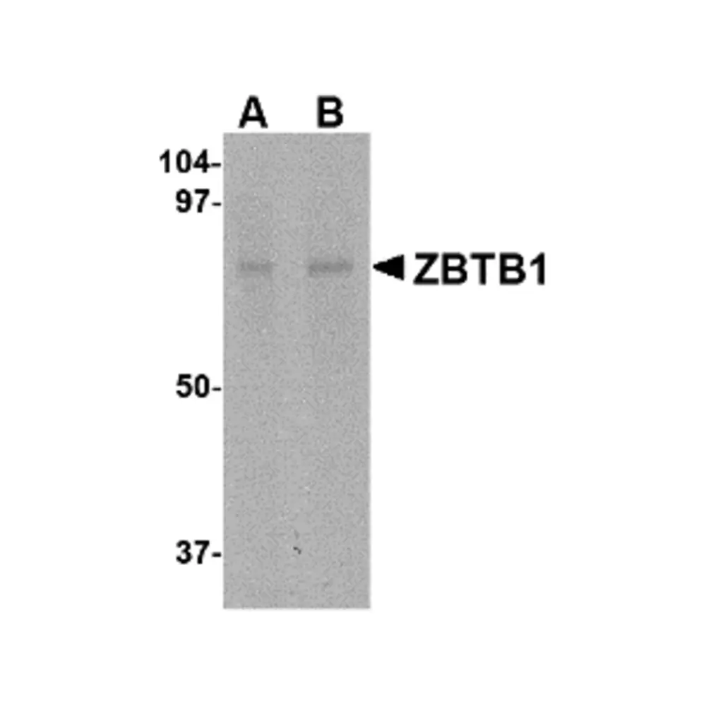 ProSci 4951 ZBTB1 Antibody, ProSci, 0.1 mg/Unit Primary Image