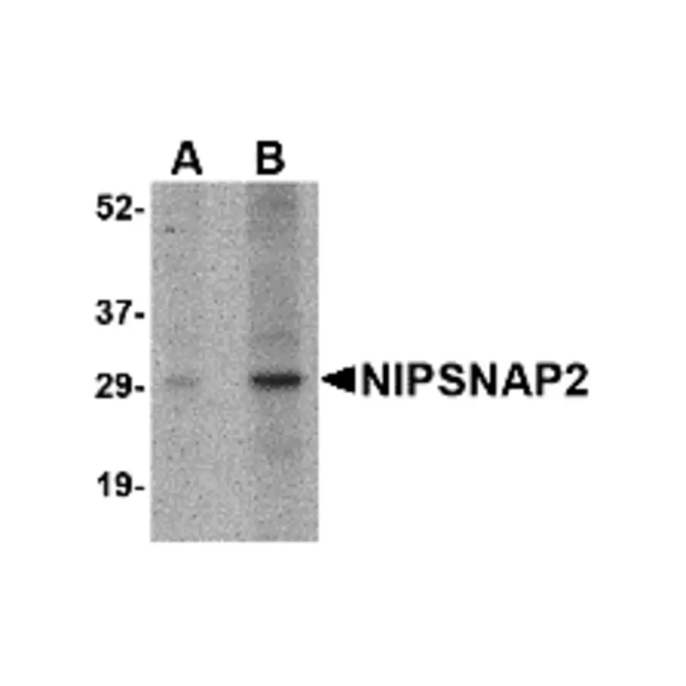 ProSci 4953_S NIPSNAP2 Antibody, ProSci, 0.02 mg/Unit Primary Image