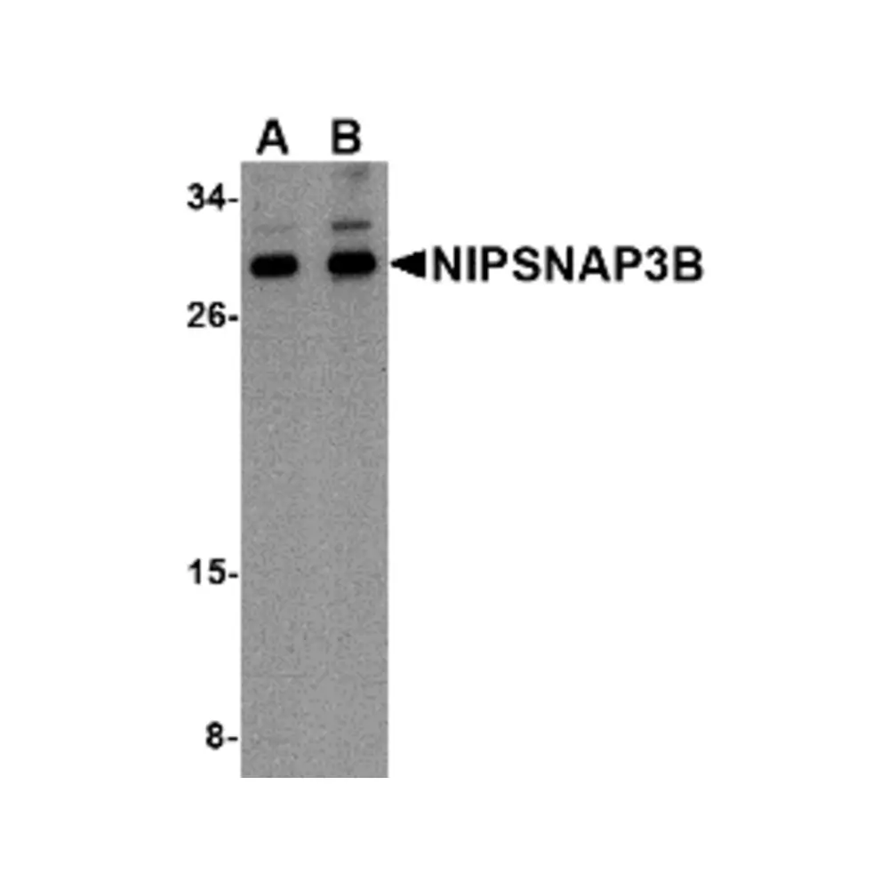 ProSci 4957_S NIPSNAP3B Antibody, ProSci, 0.02 mg/Unit Primary Image