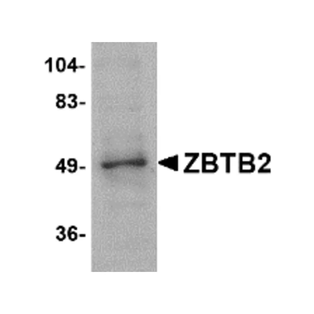 ProSci 4961_S ZBTB2 Antibody, ProSci, 0.02 mg/Unit Primary Image