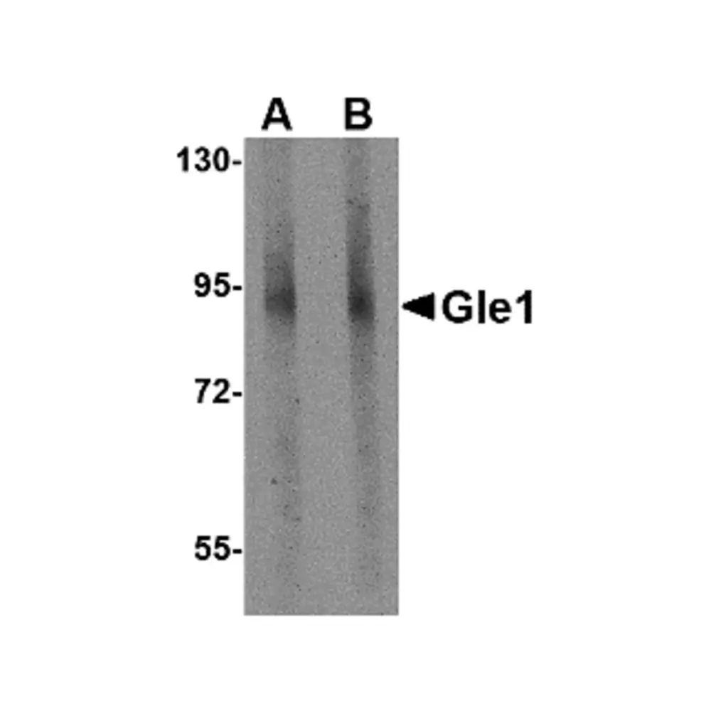 ProSci 4963 Gle1 Antibody, ProSci, 0.1 mg/Unit Primary Image