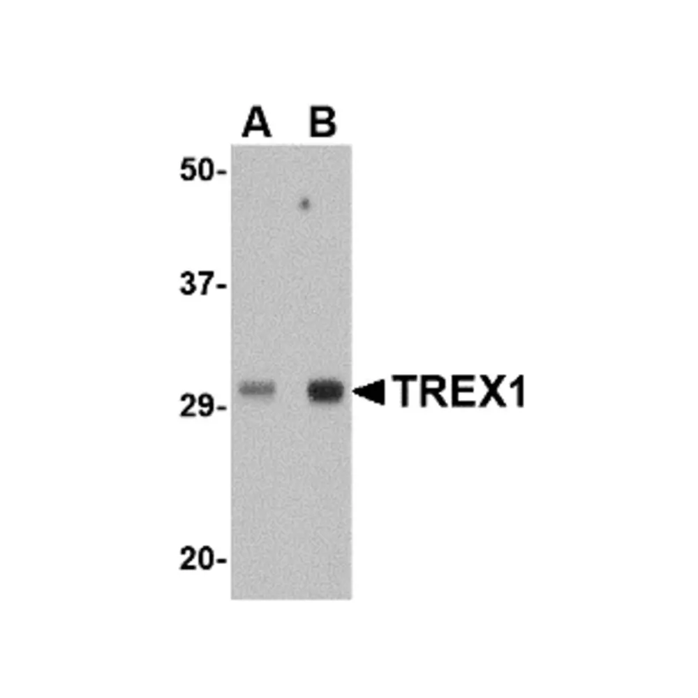 ProSci 4969 TREX1 Antibody, ProSci, 0.1 mg/Unit Primary Image
