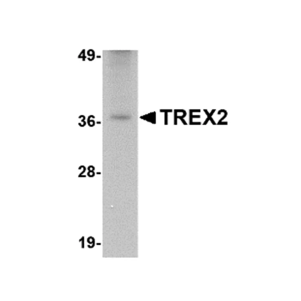 ProSci 4971_S TREX2 Antibody, ProSci, 0.02 mg/Unit Primary Image