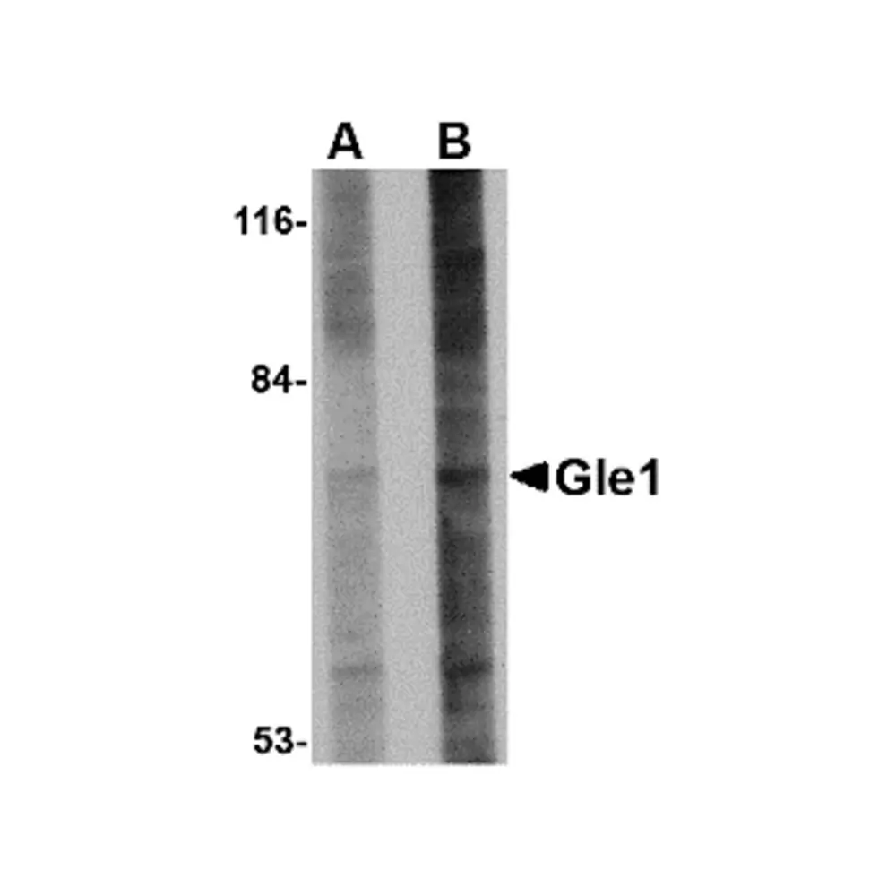 ProSci 4973 Gle1 Antibody, ProSci, 0.1 mg/Unit Primary Image