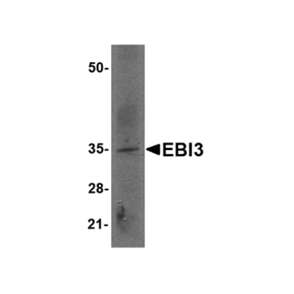 ProSci 4977 EBI3 Antibody, ProSci, 0.1 mg/Unit Primary Image