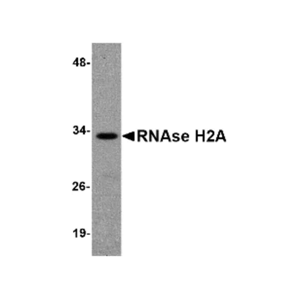 ProSci 4979 RNAse H2A Antibody, ProSci, 0.1 mg/Unit Primary Image