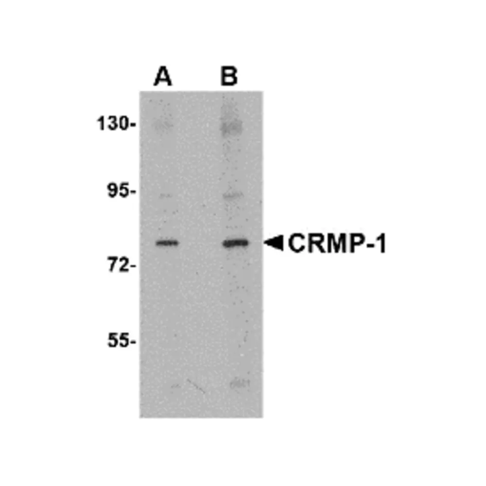 ProSci 4983 CRMP1 Antibody, ProSci, 0.1 mg/Unit Primary Image