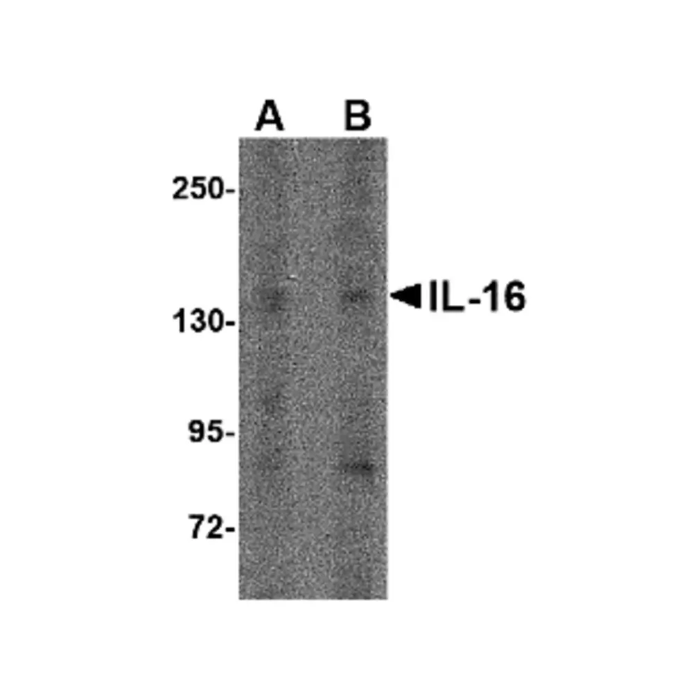 ProSci 4985_S IL-16 Antibody, ProSci, 0.02 mg/Unit Primary Image
