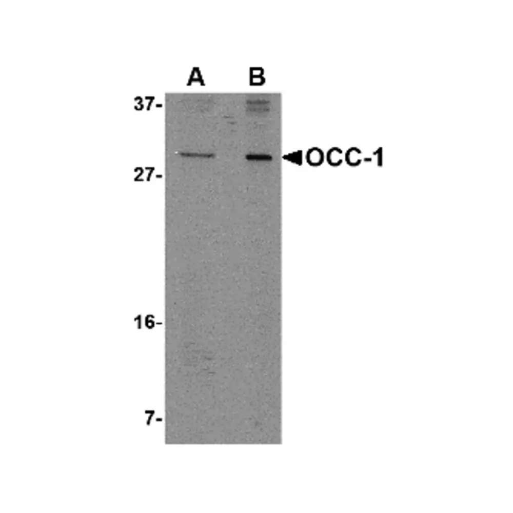 ProSci 4987_S OCC-1 Antibody, ProSci, 0.02 mg/Unit Primary Image