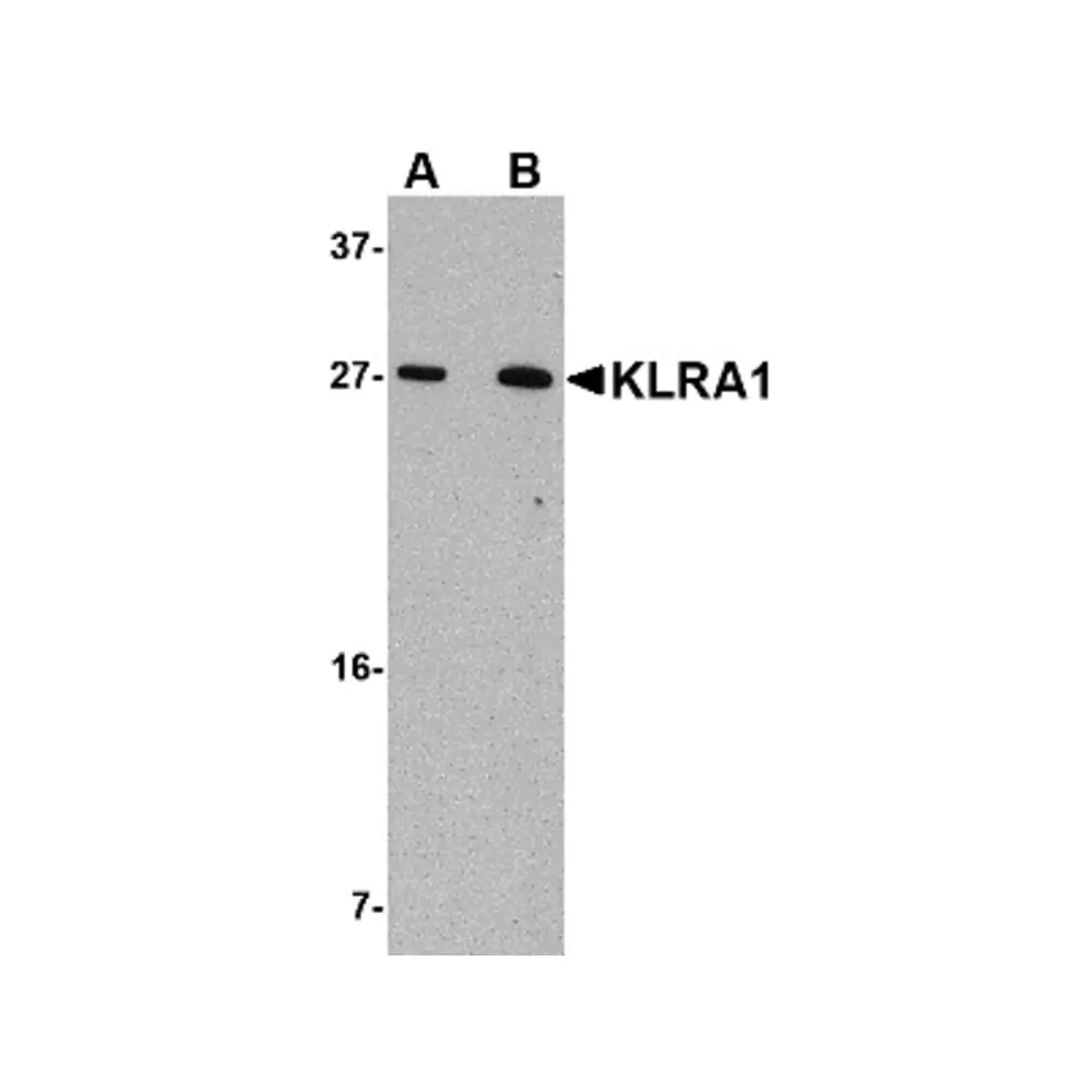 ProSci 4989 KLRA1 Antibody, ProSci, 0.1 mg/Unit Primary Image