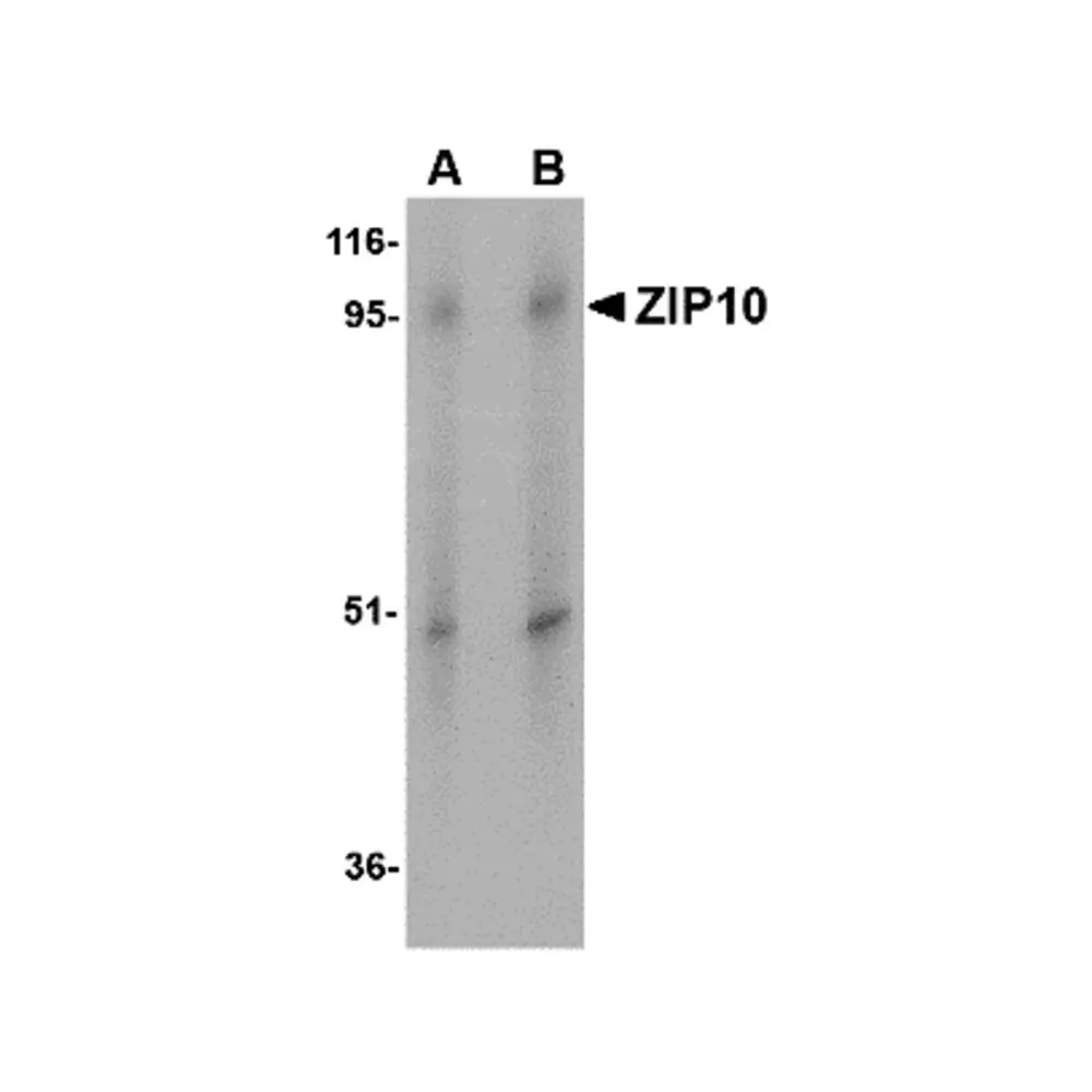 ProSci 4991_S ZIP10 Antibody, ProSci, 0.02 mg/Unit Primary Image