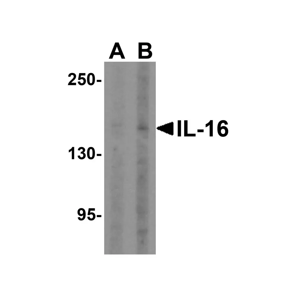 ProSci 4995_S IL-16 Antibody, ProSci, 0.02 mg/Unit Primary Image