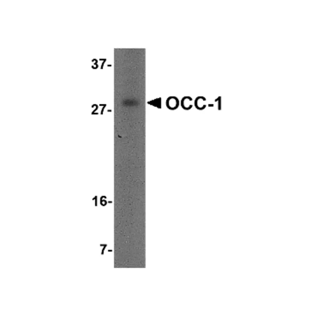 ProSci 4997 OCC-1 Antibody, ProSci, 0.1 mg/Unit Primary Image