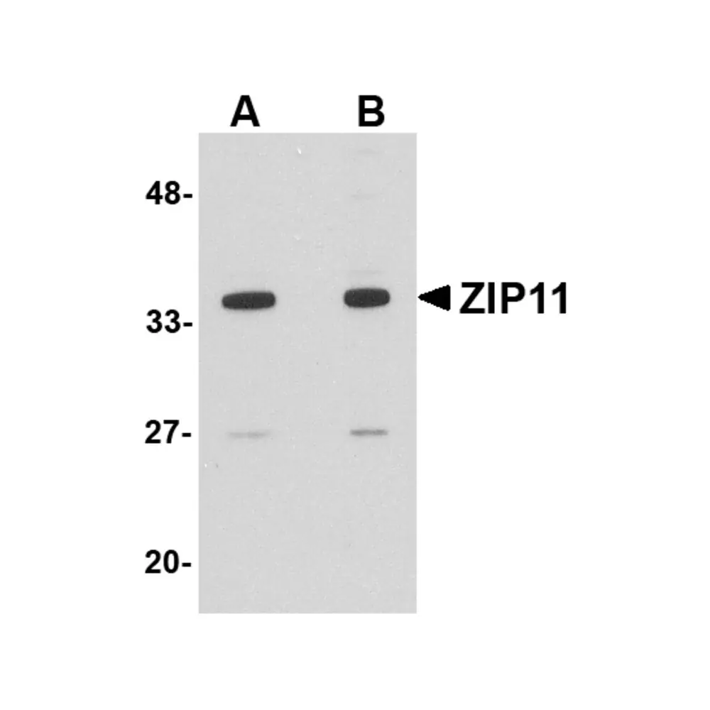 ProSci 5001_S ZIP11 Antibody, ProSci, 0.02 mg/Unit Primary Image