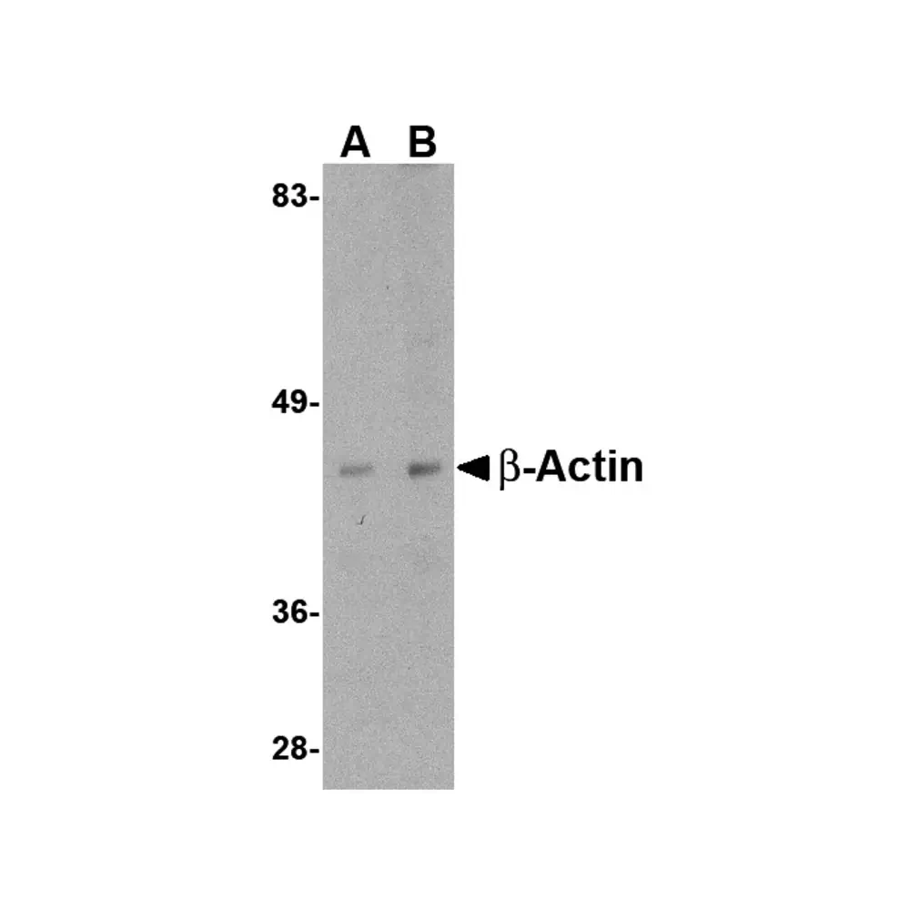 ProSci 5005 Beta-actin Antibody, ProSci, 0.1 mg/Unit Primary Image