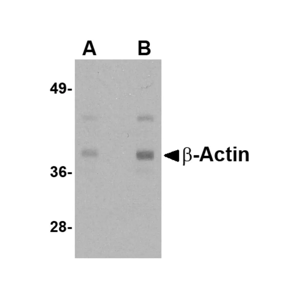 ProSci 5009_S Beta-actin Antibody, ProSci, 0.02 mg/Unit Primary Image
