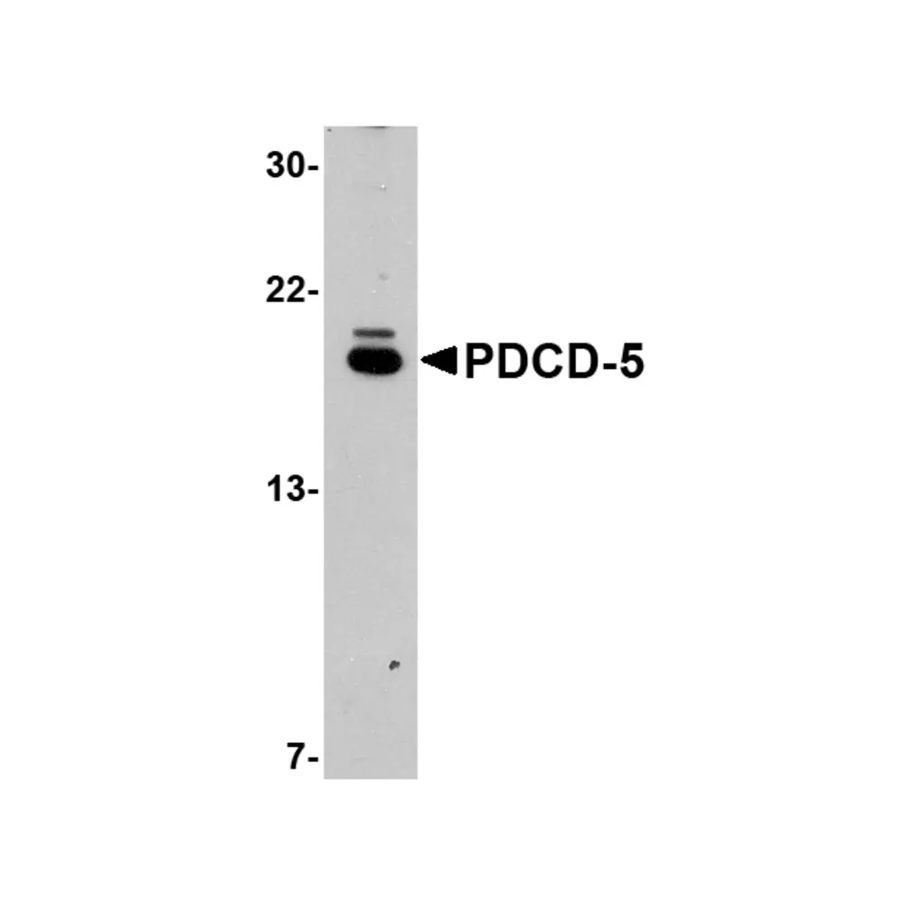 ProSci 5011_S PDCD5 Antibody, ProSci, 0.02 mg/Unit Primary Image