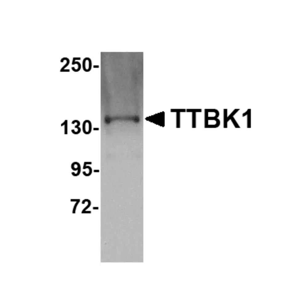 ProSci 5013_S TTBK1 Antibody, ProSci, 0.02 mg/Unit Primary Image
