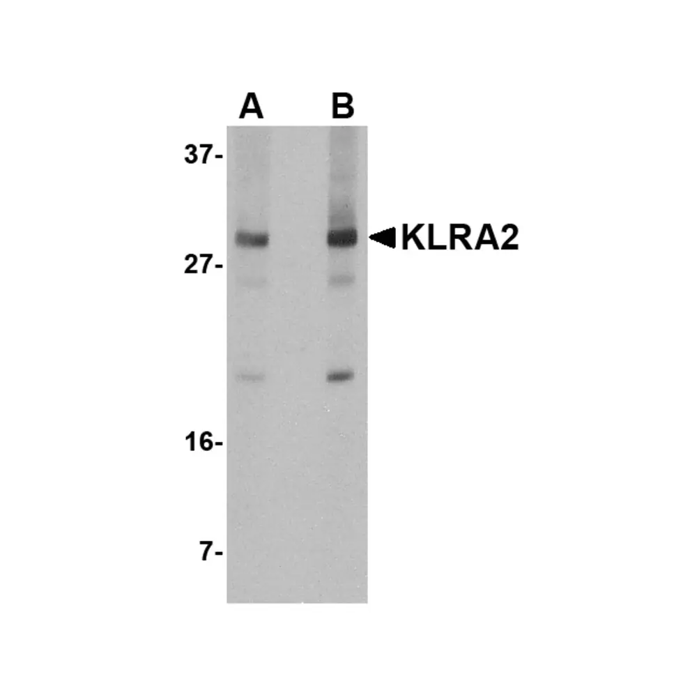 ProSci 5017_S KLRA2 Antibody, ProSci, 0.02 mg/Unit Primary Image