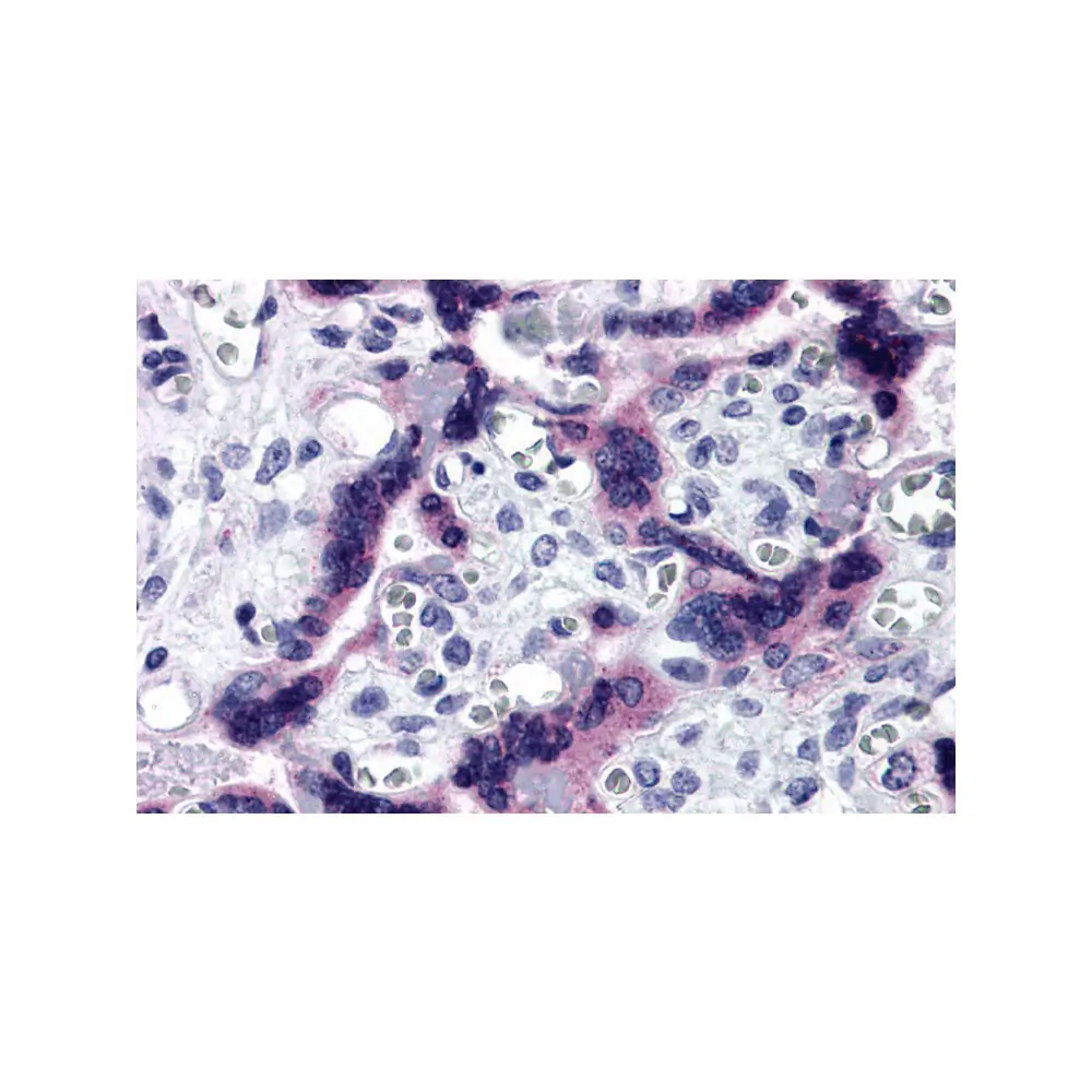 ProSci 5021 TTBK2 Antibody, ProSci, 0.1 mg/Unit Primary Image