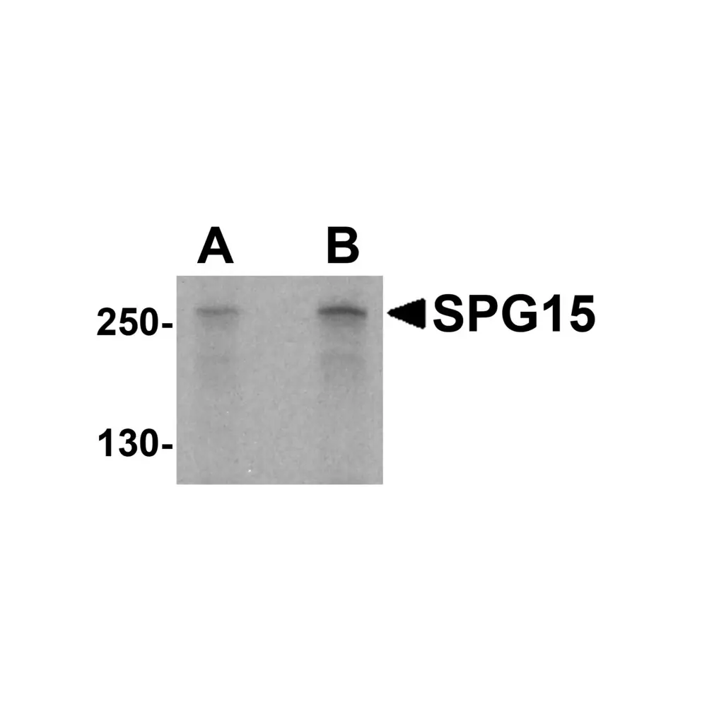 ProSci 5023_S SPG15 Antibody, ProSci, 0.02 mg/Unit Primary Image