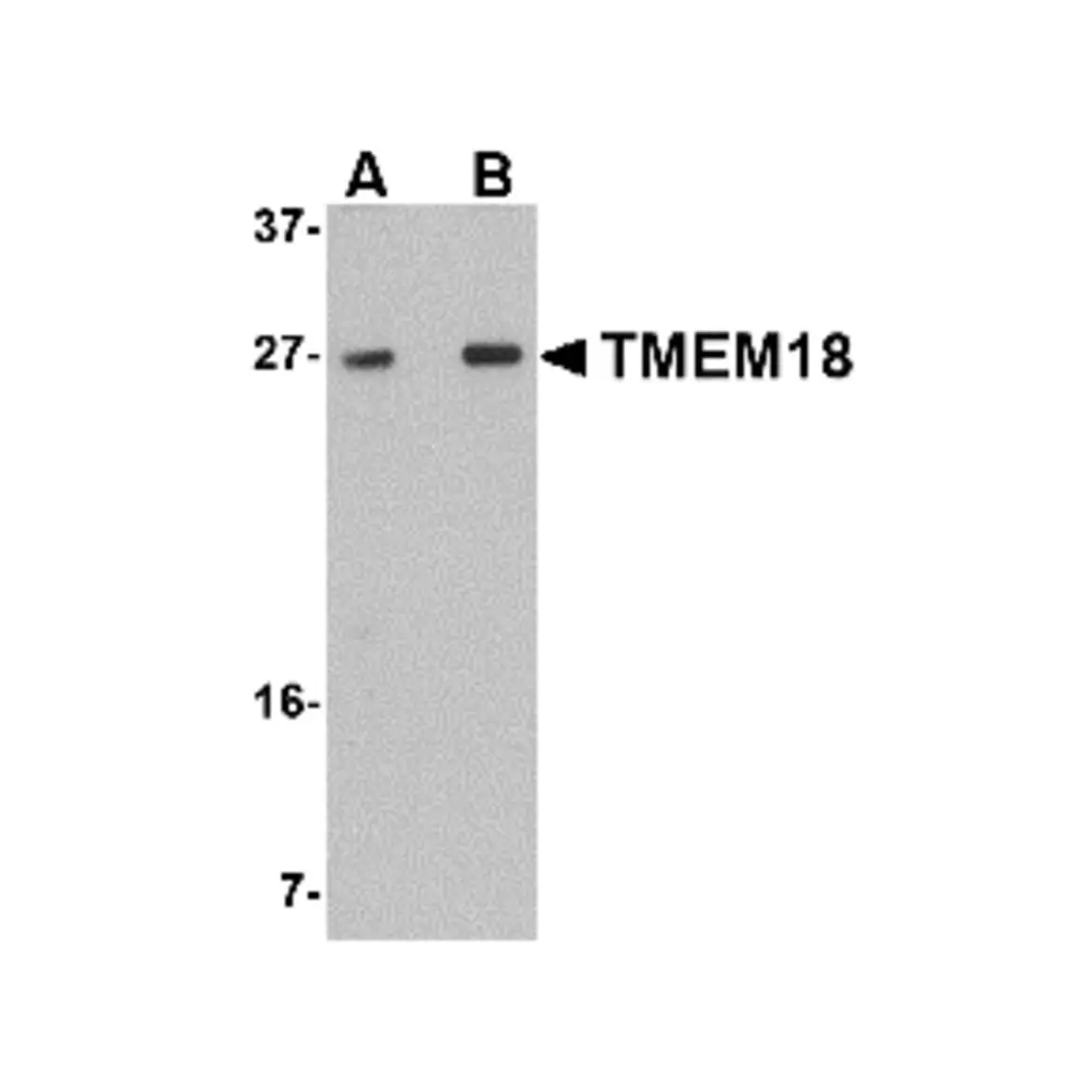 ProSci 5043 TMEM18 Antibody, ProSci, 0.1 mg/Unit Primary Image