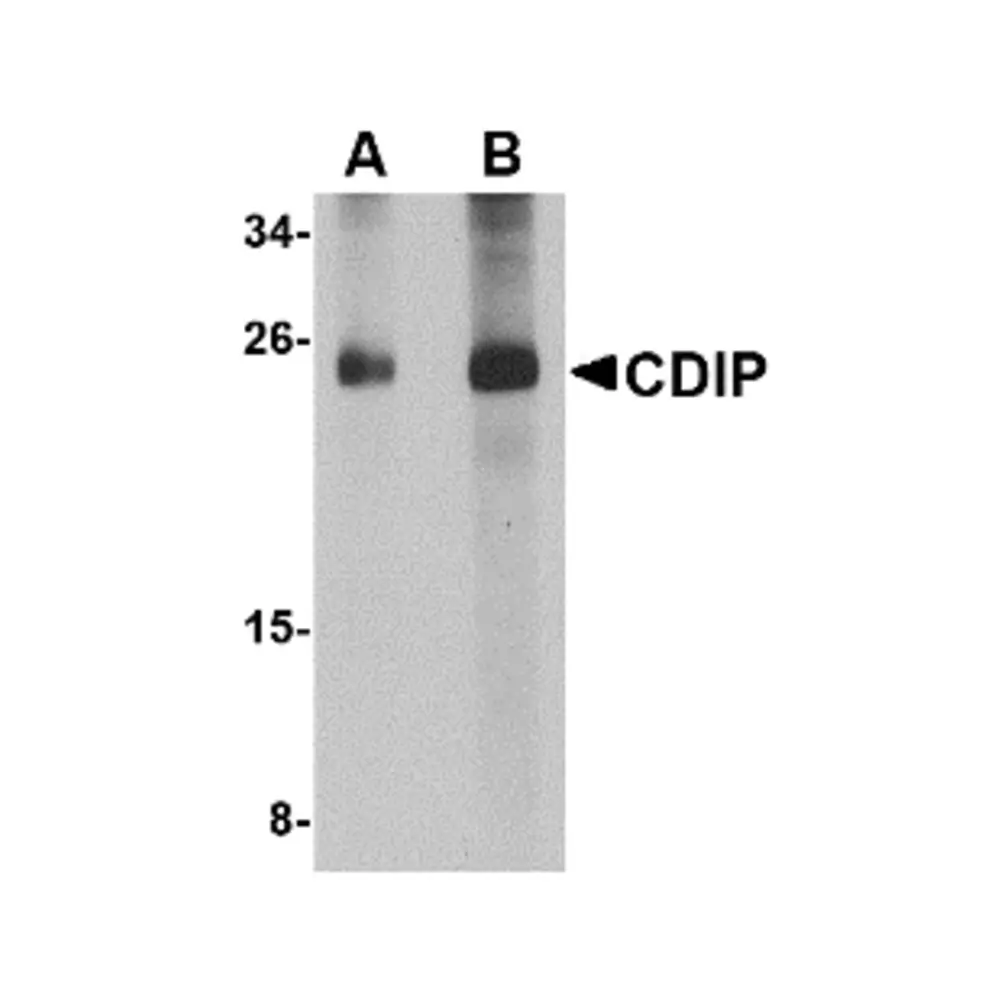 ProSci 5047 CDIP Antibody, ProSci, 0.1 mg/Unit Primary Image