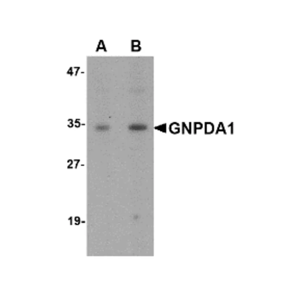 ProSci 5049 GNPDA1 Antibody, ProSci, 0.1 mg/Unit Primary Image
