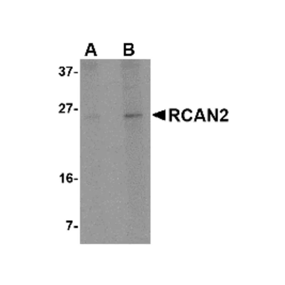 ProSci 5051 RCAN2 Antibody, ProSci, 0.1 mg/Unit Primary Image