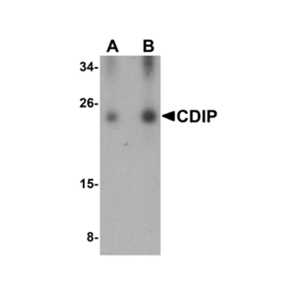 ProSci 5059_S CDIP Antibody, ProSci, 0.02 mg/Unit Primary Image