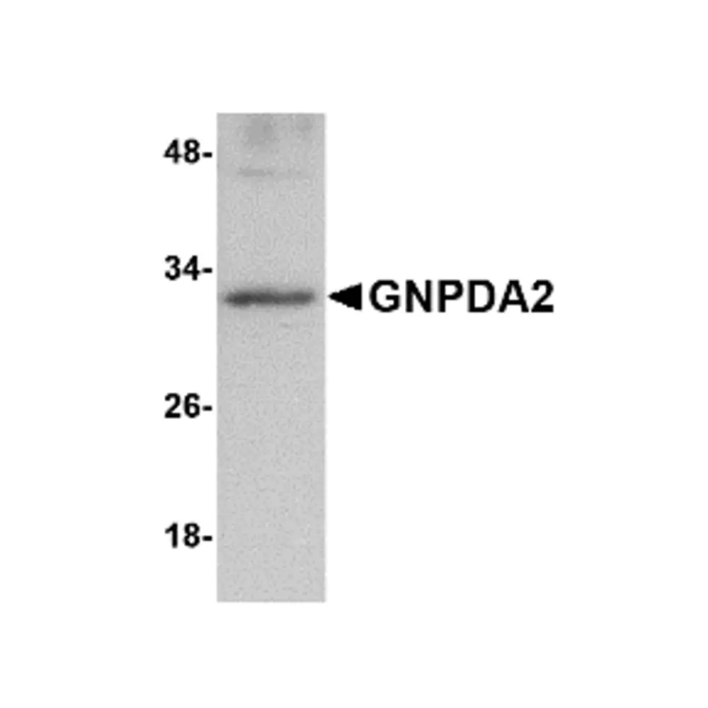 ProSci 5061 GNPDA2 Antibody, ProSci, 0.1 mg/Unit Primary Image