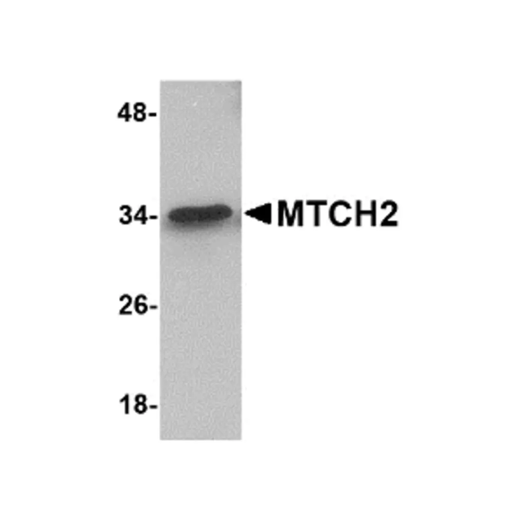 ProSci 5063_S MTCH2 Antibody, ProSci, 0.02 mg/Unit Primary Image