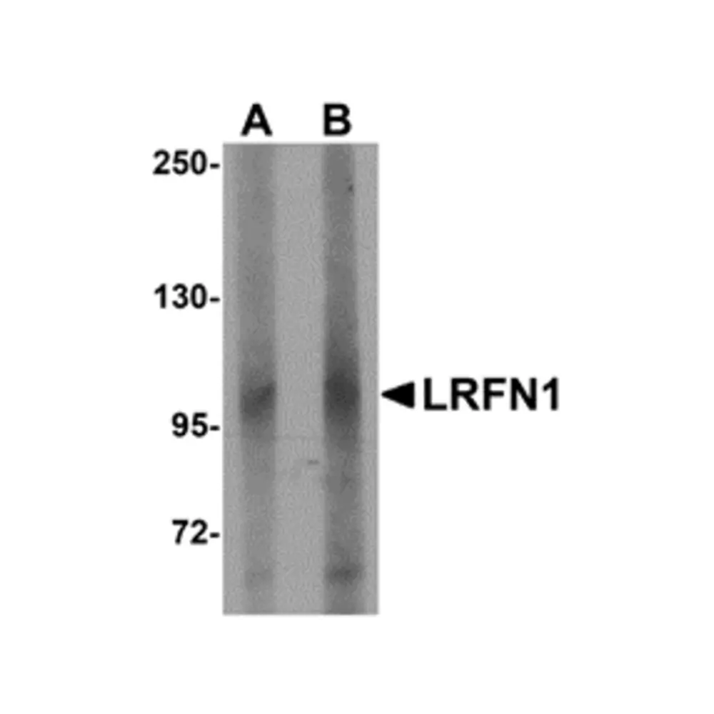 ProSci 5065 LRFN1 Antibody, ProSci, 0.1 mg/Unit Primary Image