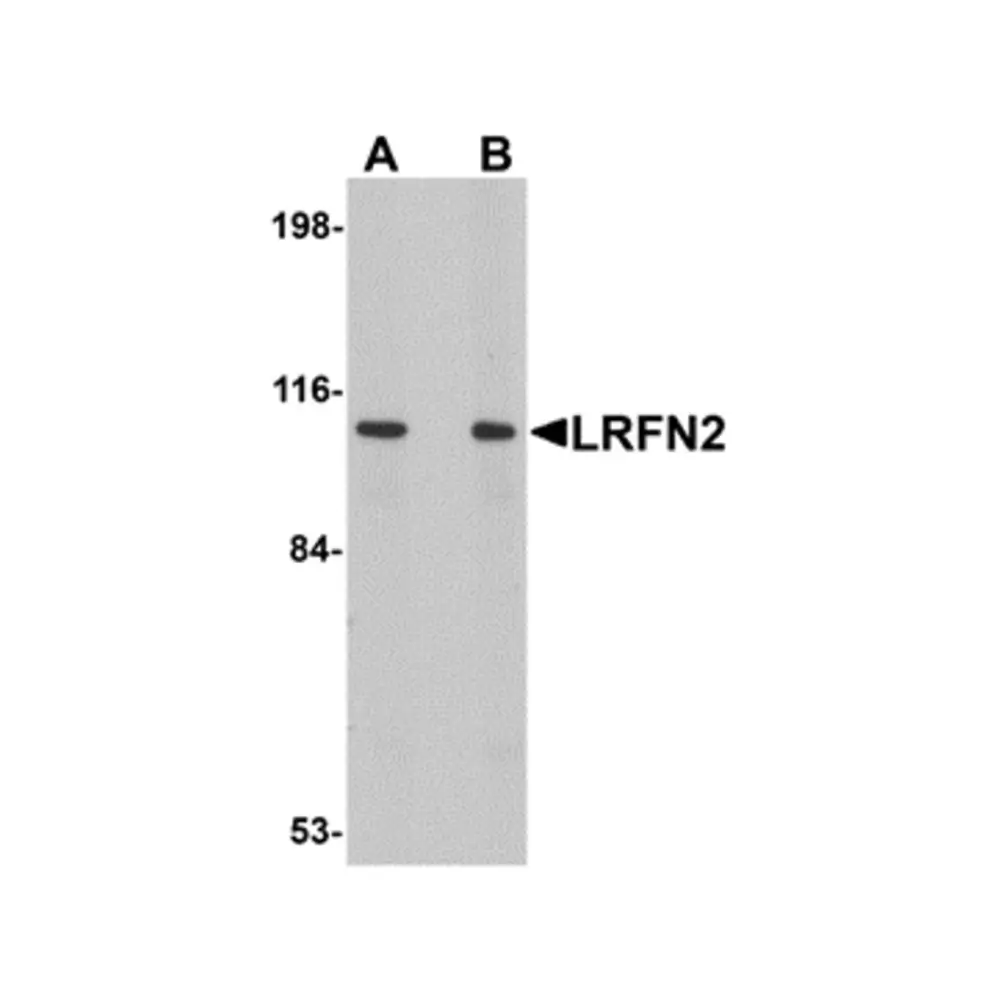 ProSci 5067 LRFN2 Antibody, ProSci, 0.1 mg/Unit Primary Image