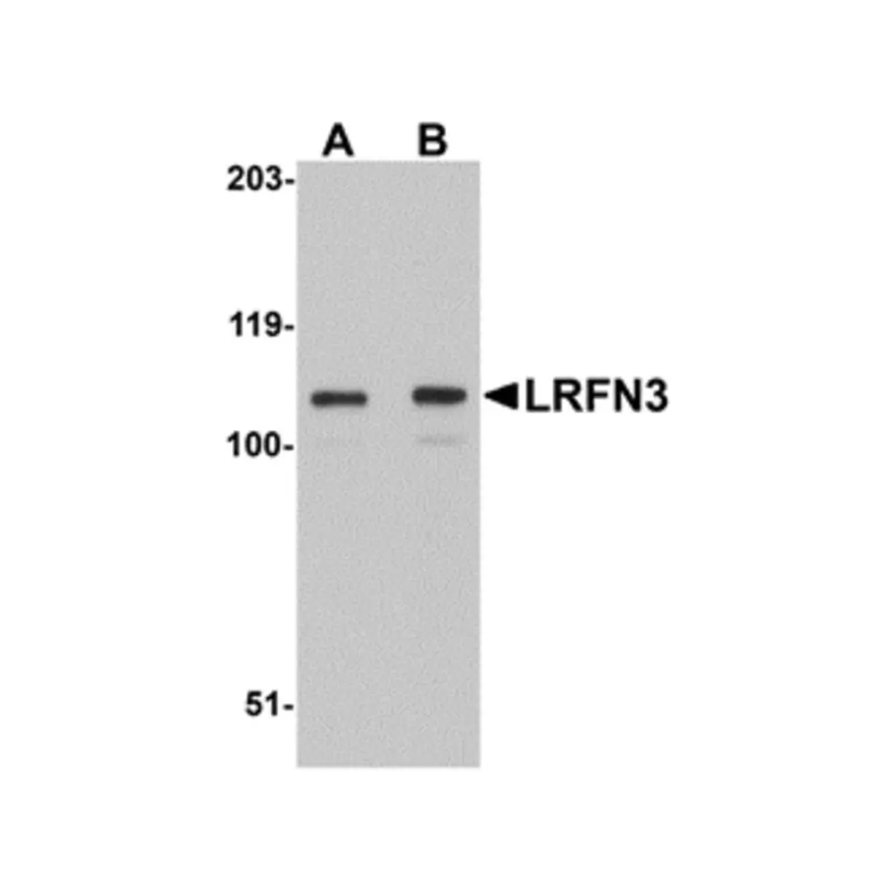 ProSci 5069 LRFN3 Antibody, ProSci, 0.1 mg/Unit Primary Image